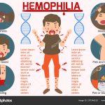 penyakit genetik Hemofilia